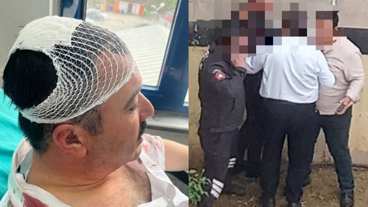 Yeniden Refah Partili yönetici, başkan yardımcısını yaraladı