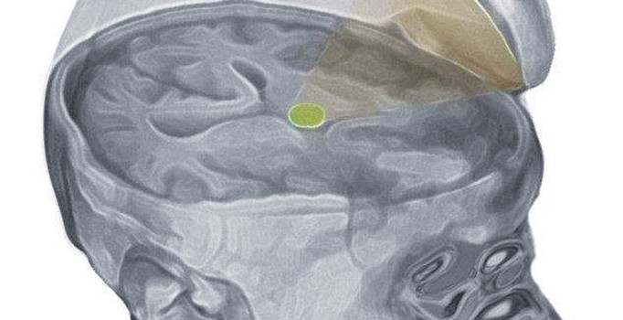 Doktorlar komadaki hastayla tarih yazdı