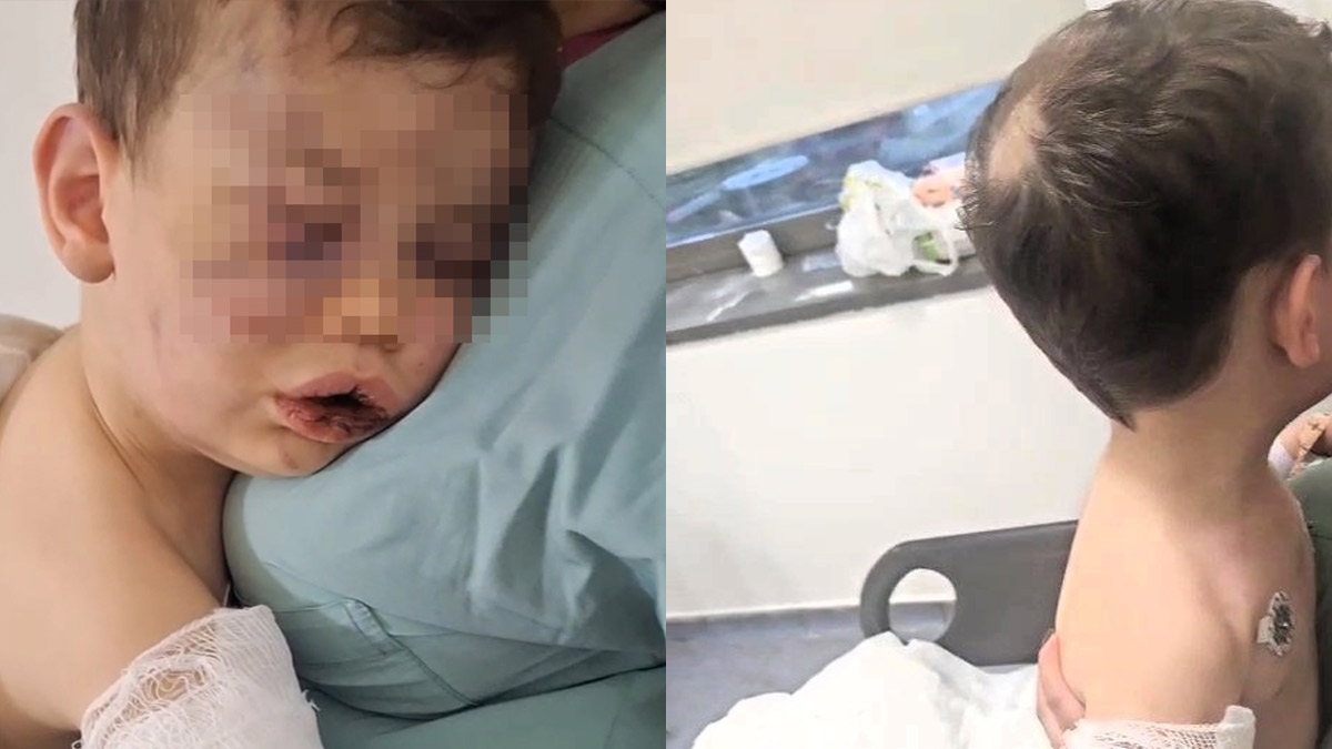 Denizli'de korkunç olay! 2 yaşındaki çocuk, annesinin erkek arkadaşı tarafından dövüldü