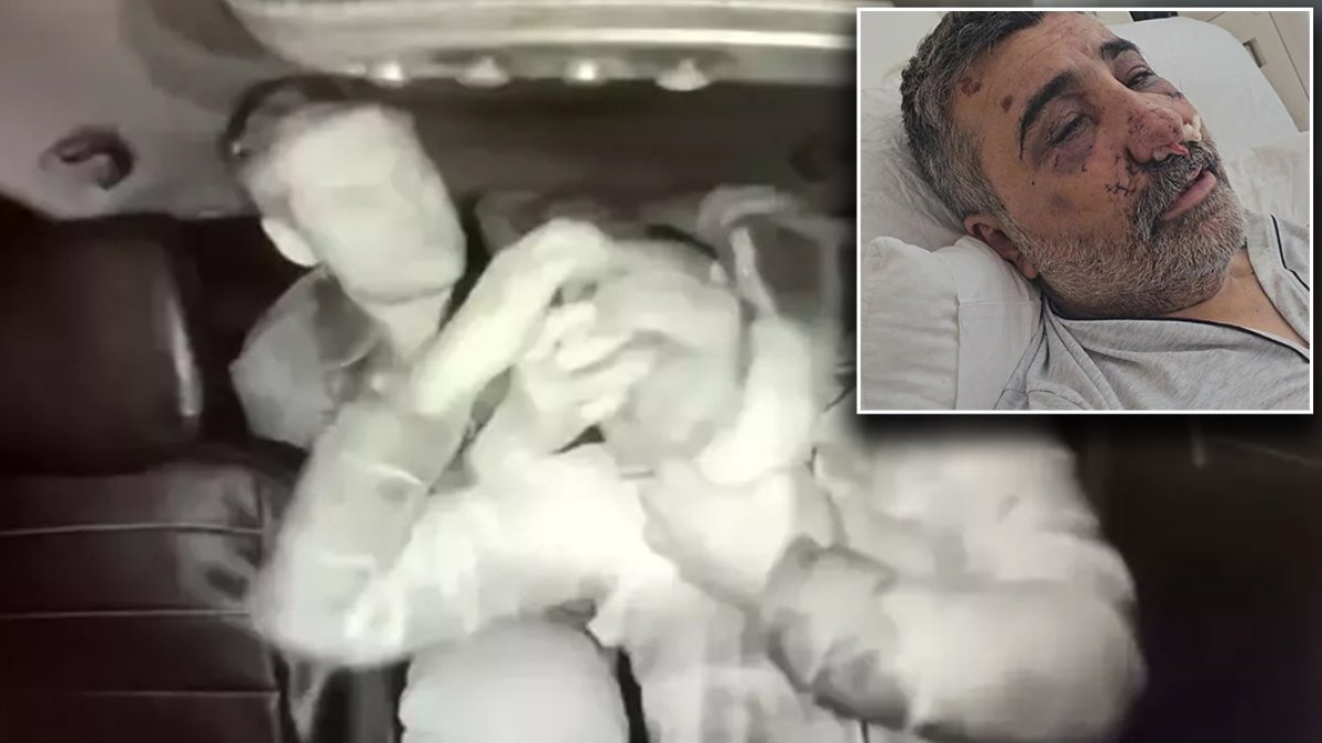 İngiliz boksörün darbettiği taksici konuştu: Öptü, ısırdı, elini gözüme soktu