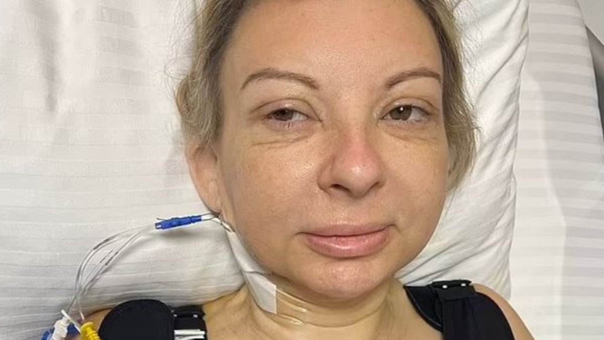 Estetik ameliyat olduğuna pişman oldu: Hayal kırıklığıyla yaşıyor: Keşke hiç kalkışmasaydım