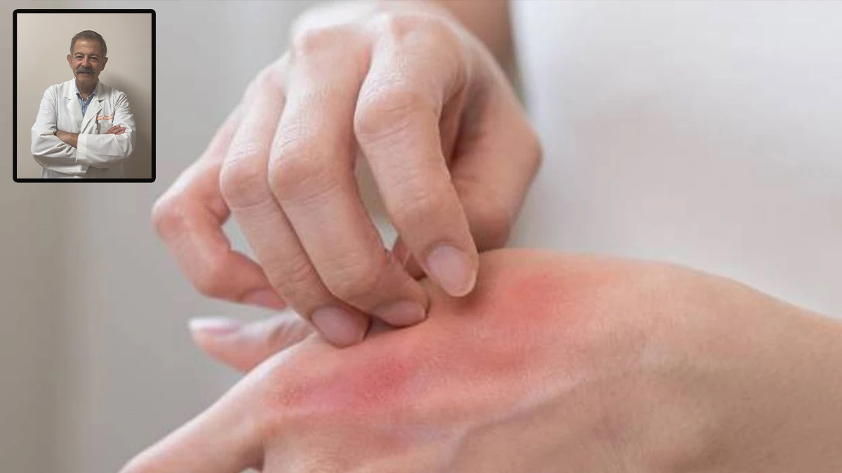 Türkiye alerji konusunda alarm veriyor: Halkın yüzde 20'sinde alerjik belirtiler var