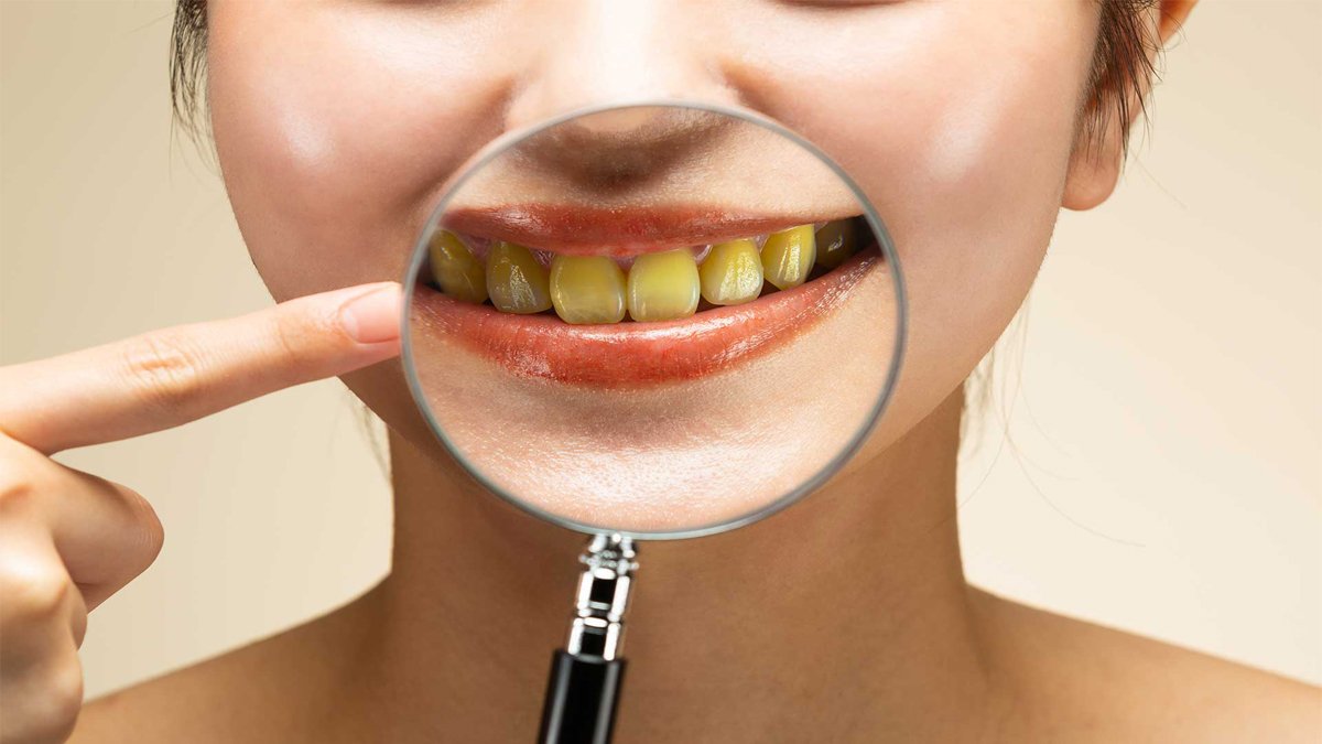 Sararan dişlere doğal çözüm: Bu karışımla ışıl ışıl bir gülüş sizi bekliyor!