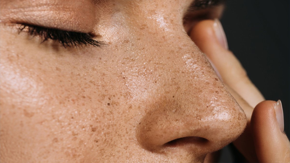 Evde peeling etkisi! Cildiniz ışıl ışıl olacak, gören sırrınızı soracak