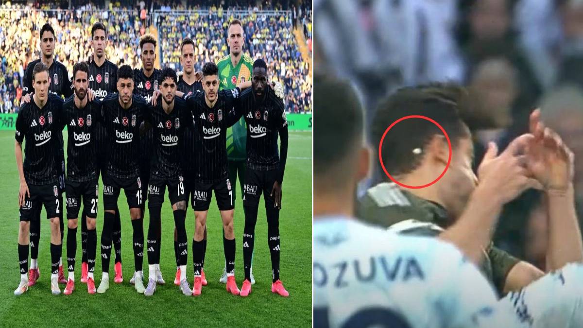 Böylesi sahalarda ilk kez görüldü! Beşiktaşlı yıldızın maçta dişi fırladı: O anlar böyle görüntülendi