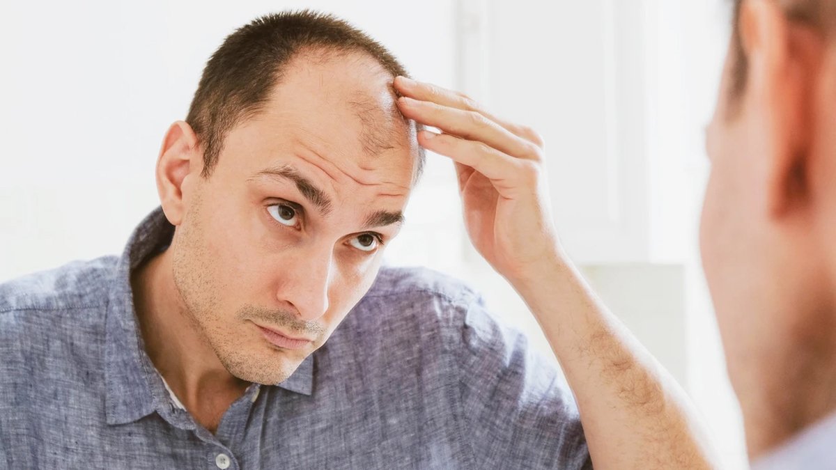 Saçlarım dökülüyor diyen her erkeğin okuması gerekiyor! Erkeklerde saç dökülmesine karşı bu yağlar gerçekten işe yarıyor