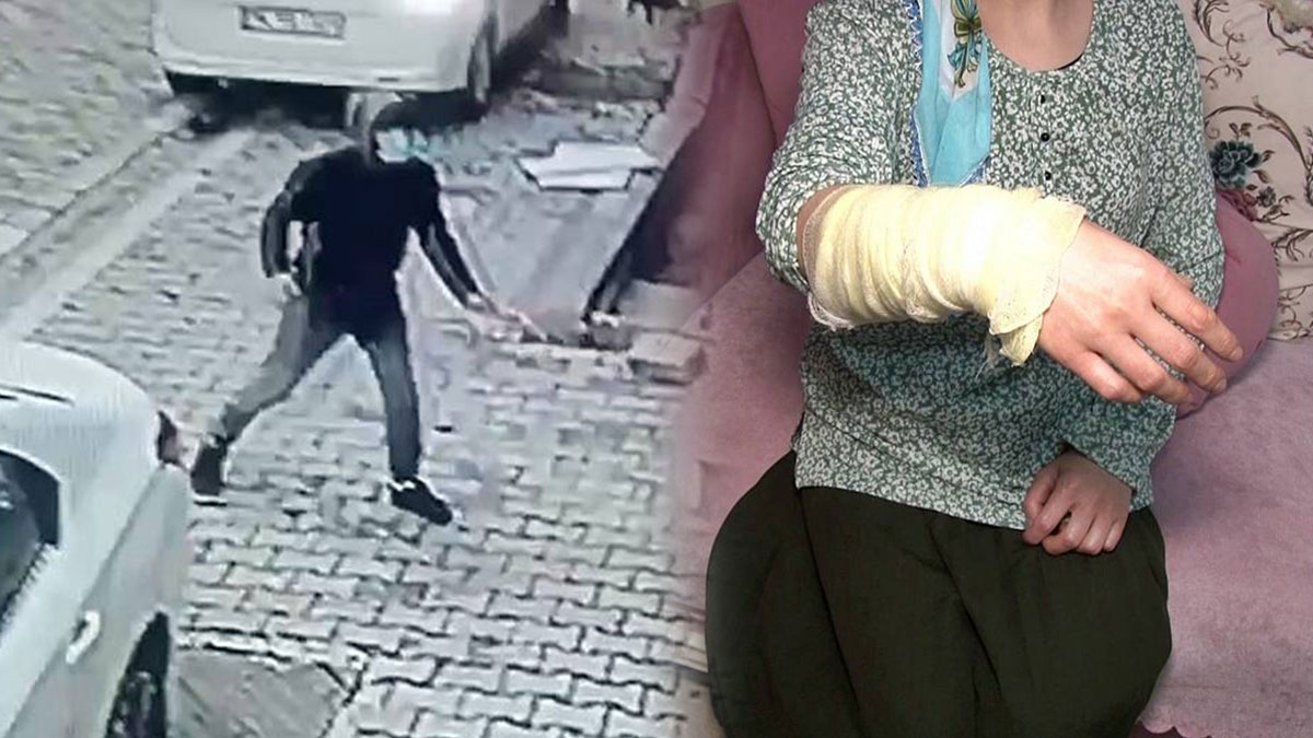 Eşi aşağı inmeyince penceresinden içeri kezzap attı! Şimdi de 'Oturduğun evi yakacağım' diye tehdit ediyor