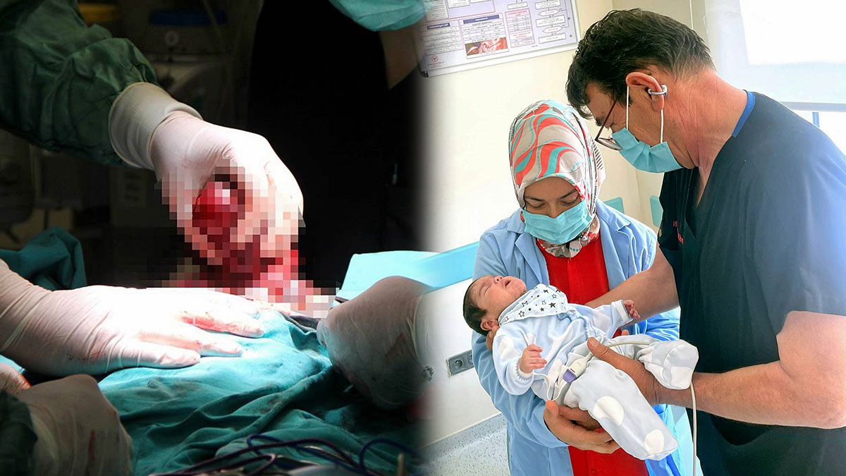 Kütahya'da doğan bebek, tıp literatürüne dünyada 7. vaka olarak geçti! Türk doktorlarının tarihi başarısı