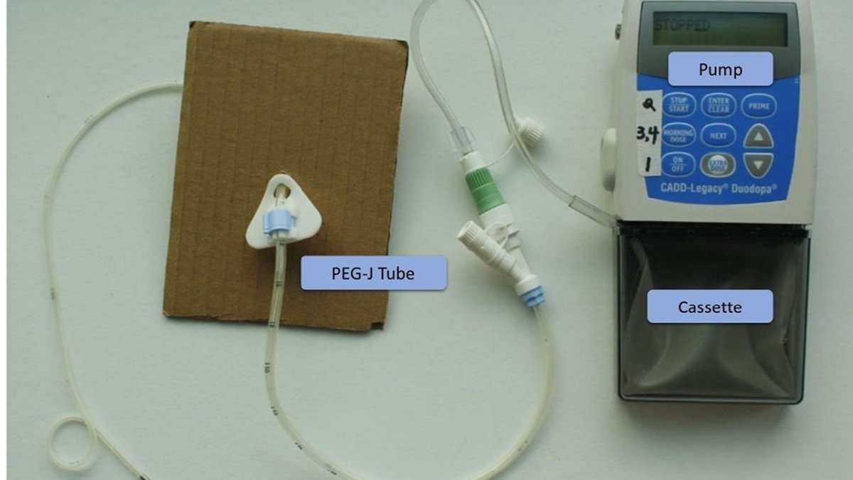 Parkinson tedavisinde yeni dönem: Kaset jel yöntemiyle umut veren uygulama! 12 ilaçtan aynı anda kurtarıyor