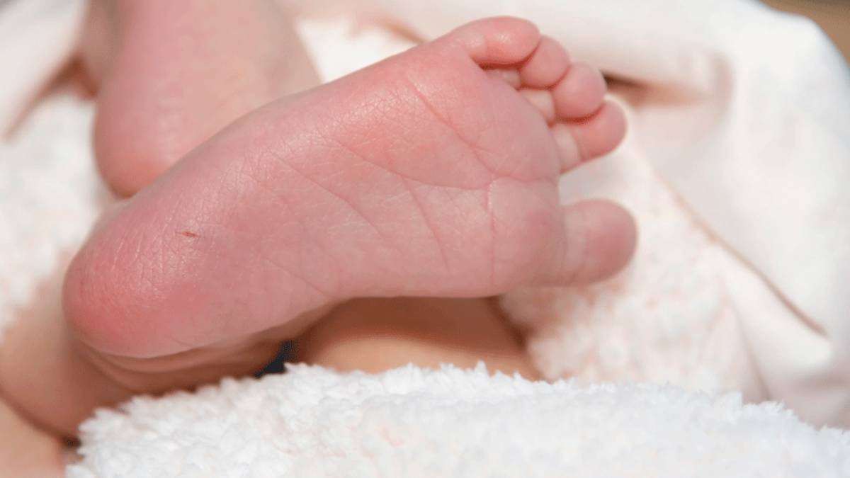 Ülkemizde her 25 kişiden biri fenilketonüri taşıyıcısı