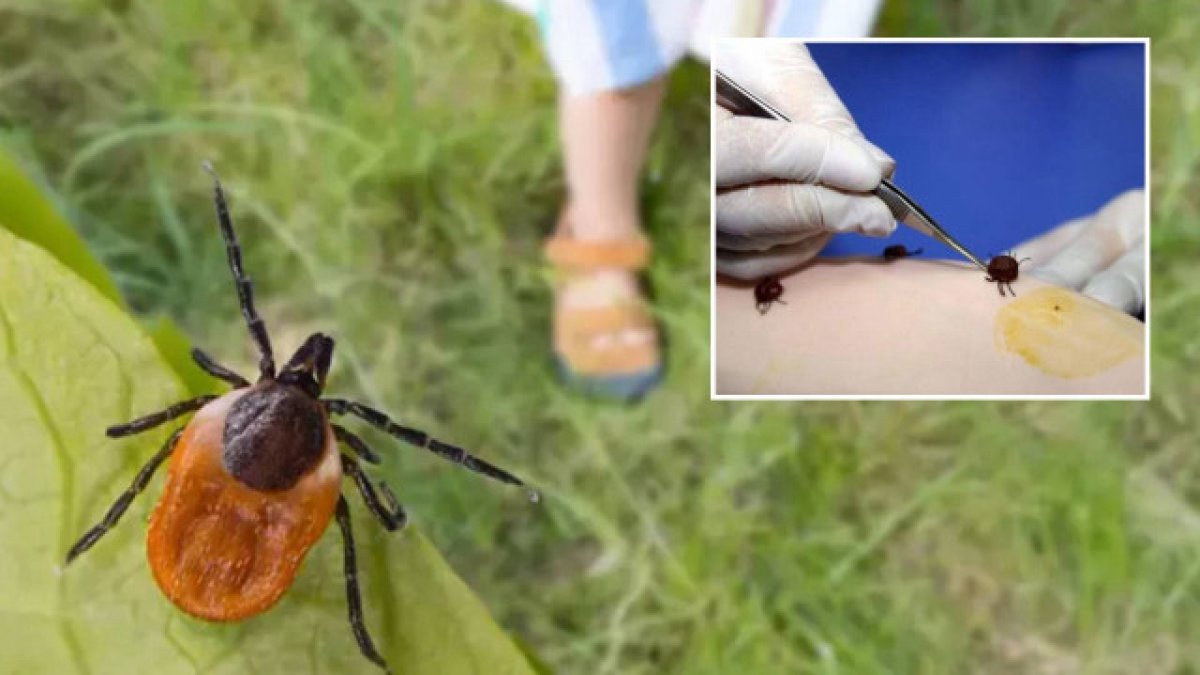 Kayseri’de kene vakası: KKKA şüphesiyle hastaneye kaldırılan çiftçi yaşamını yitirdi