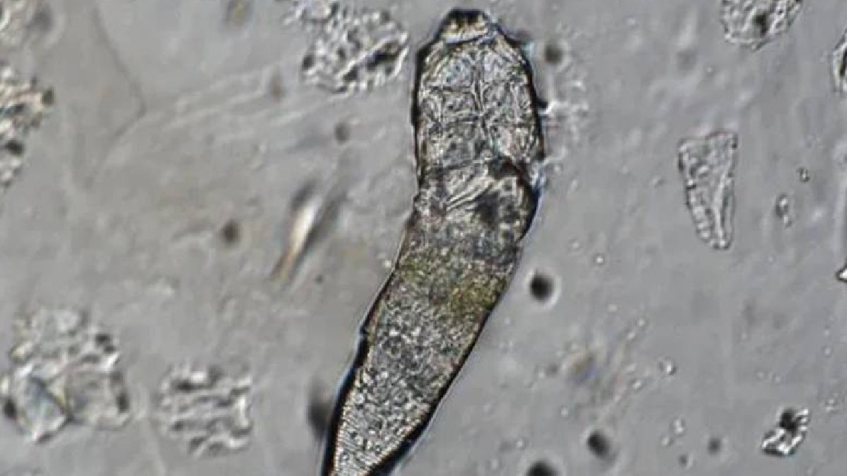 Cildimizde yaşayan sürüngenler: Geceleri çiftleşip sabah kayboluyorlar