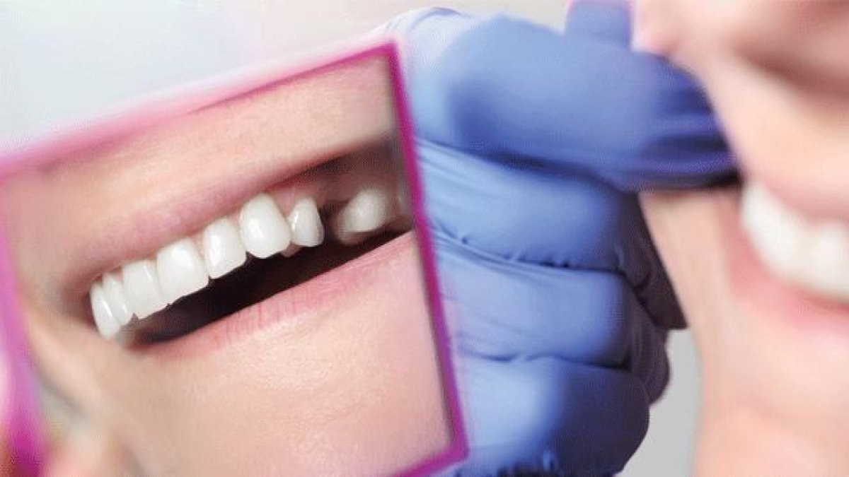 Diş çekiminde ölümcül tehlike! Uzman uyardı: “Basit sanmayın, hayati sonuçlar doğurabilir”