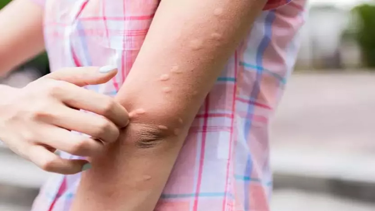 Evde, bahçede, tatilde... Sivrisinekleri kendinizden uzak tutmanın en doğal yolları bu listede!