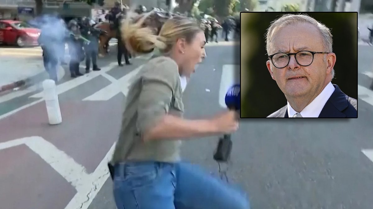 Avustralya lideri Albanese, Los Angeles’ta vurulan muhabire ilişkin konuştu: Güvenlik güçleri kasten hedef aldı