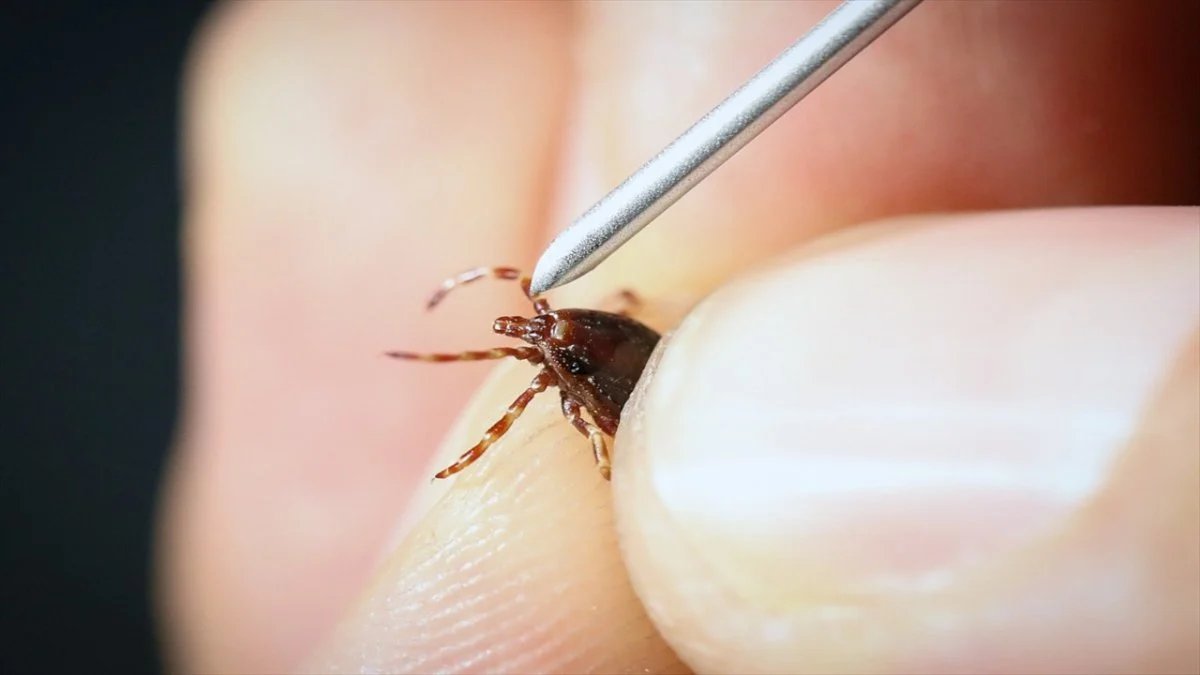 Kene ısırığı nasıl anlaşılır? Sinek ısırığıyla karıştırılabiliyor: İşte cevabı