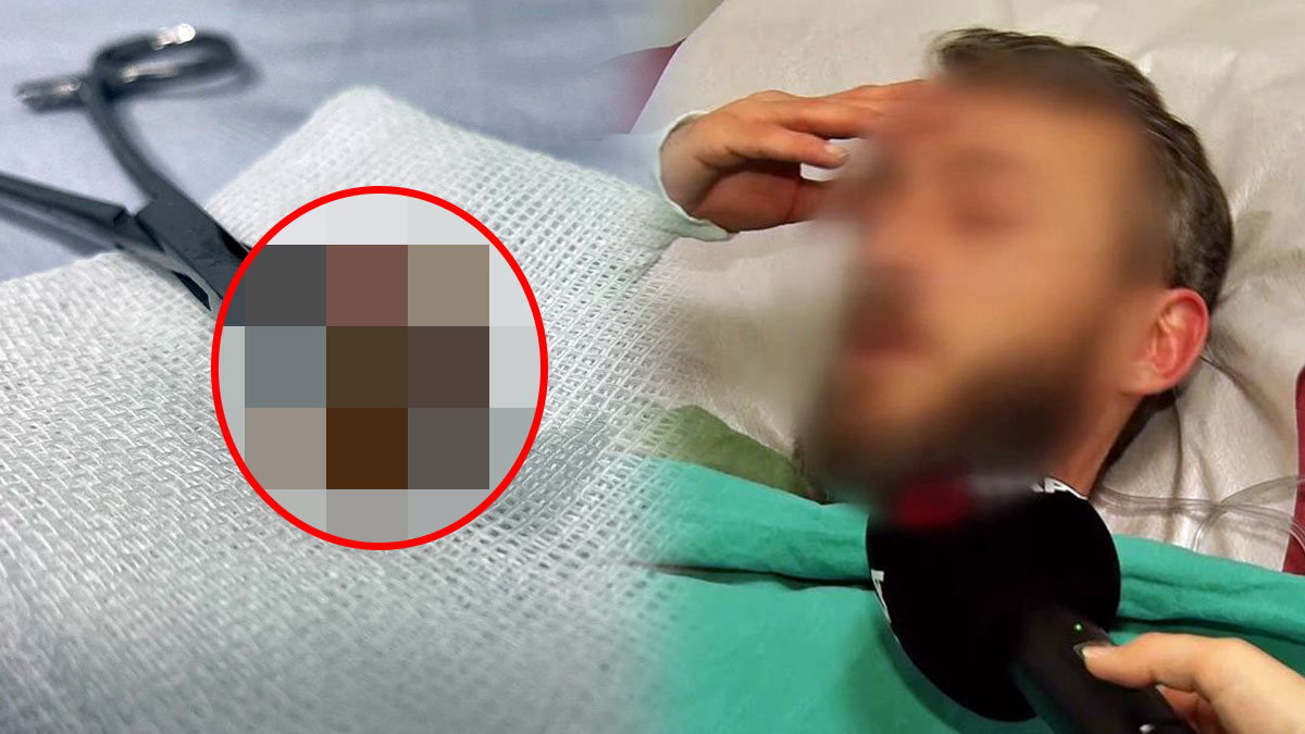 Komik ama gerçek: Kaybolan dişleri akciğerinde çıktı! Nefes darlığı ve geçmeyen öksürük varsa dikkat