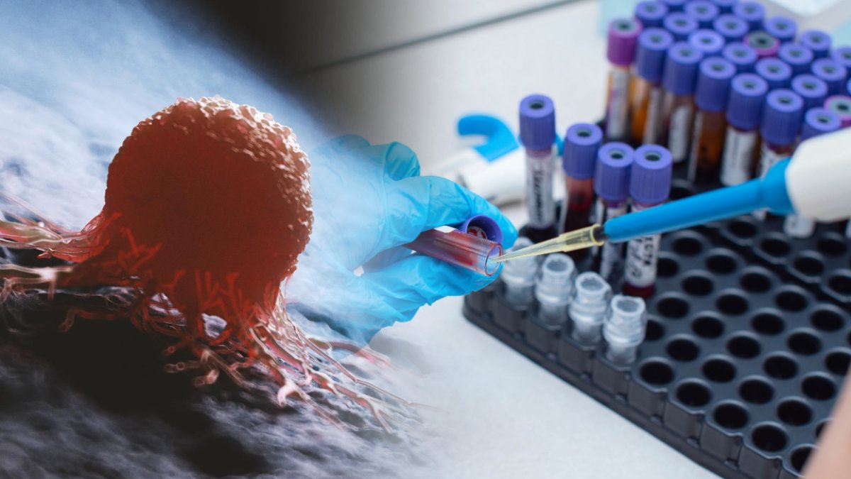 Bilim insanlarından yeni çalışma! Kanser teşhisinde ultra hassas kan testi: Teşhisten 3 yıl öncesine kadar tespit edilebiliyor