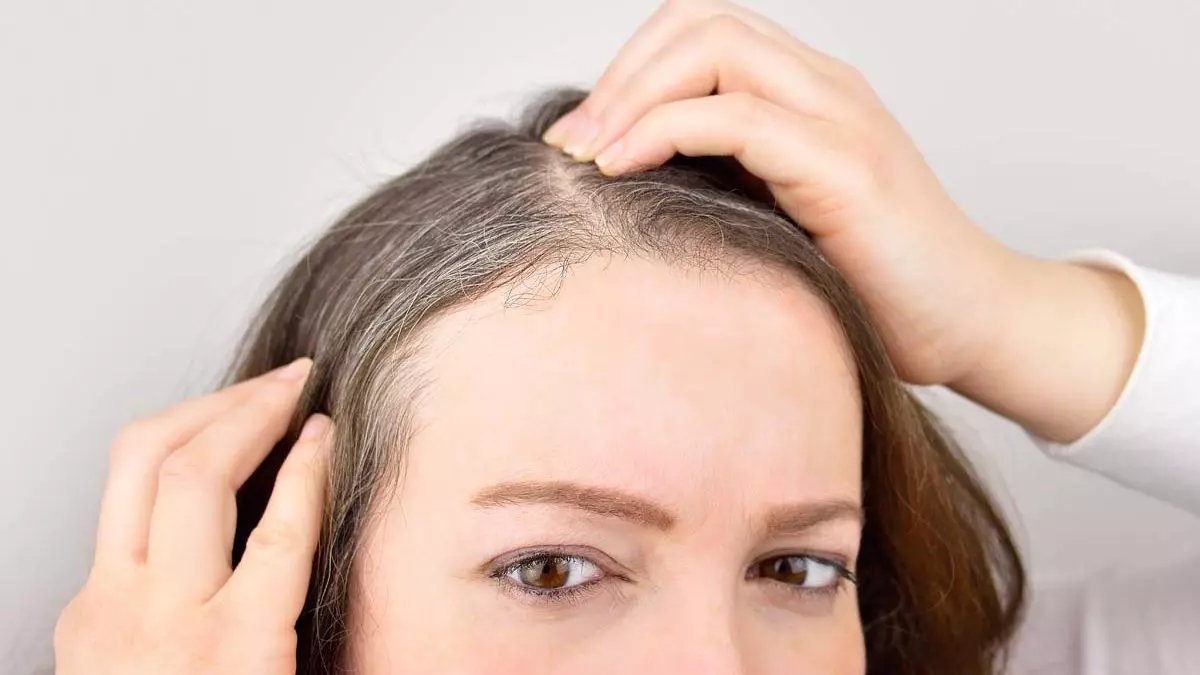 Saçlarınızdaki beyazları gizlemek için kuaförlere para dökmeye gerek yok! Bunları kullanmanız yetiyor