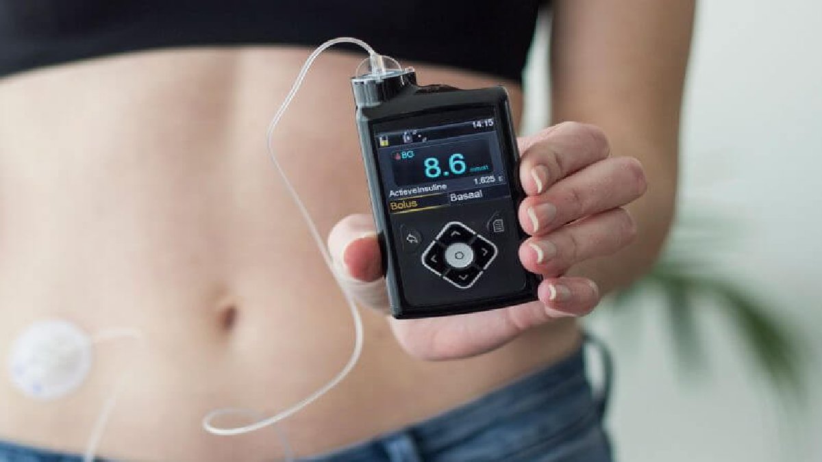 Yeni sağlık çılgınlığı: Şeker hastası değiller ama kilo vermek için kollarına bunu takıyorlar