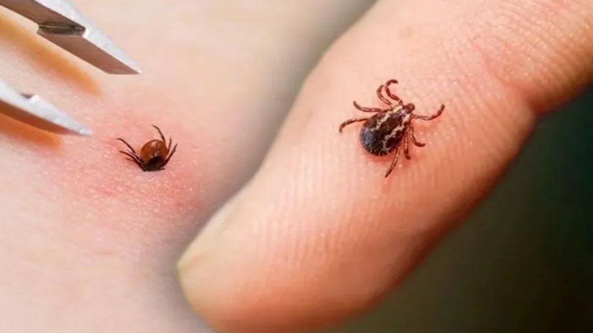 İstanbul'da kene vakaları arttı: Hangi tür riskli?