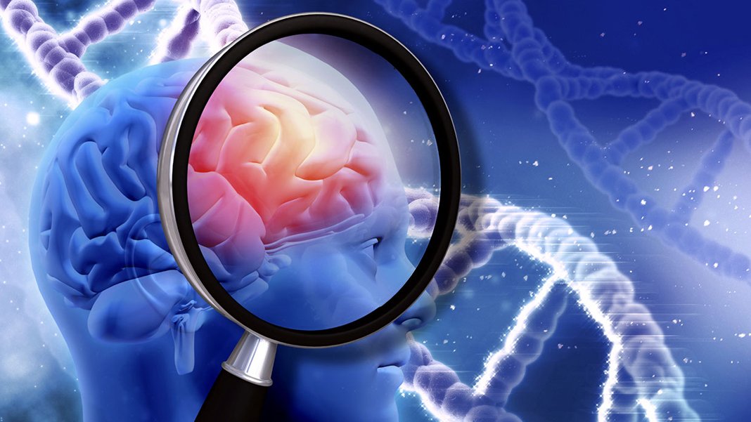 Dünyanın en genç alzheimer hastası: 19 yaşındaki gence şok teşhis