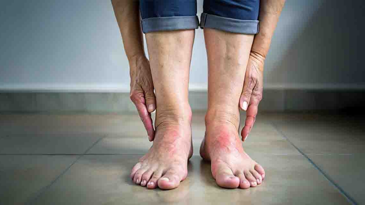 İlaç kullanmadan ödemden kurtulmak mümkün! Her sabah 1 bardak için, şişkinlikten eser kalmasın!