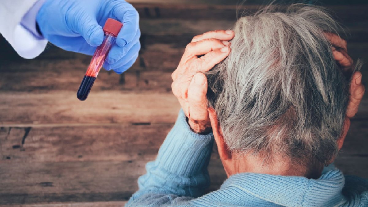 Türk bilim insanlarından umut veren araştırma: Alzheimer kan testiyle erken teşhis edilebilir