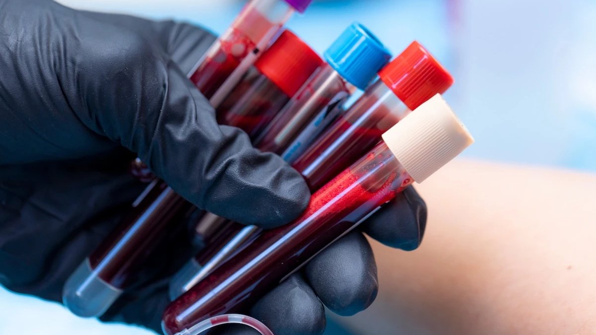 Yeni kan grubu keşfedildi: Sadece bir kişide görüldü