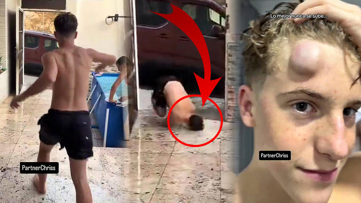 Havuz macerası kötü bitti: Kafasında dev bir yumurta çıktı! Dikkatsizlik pahalıya patladı