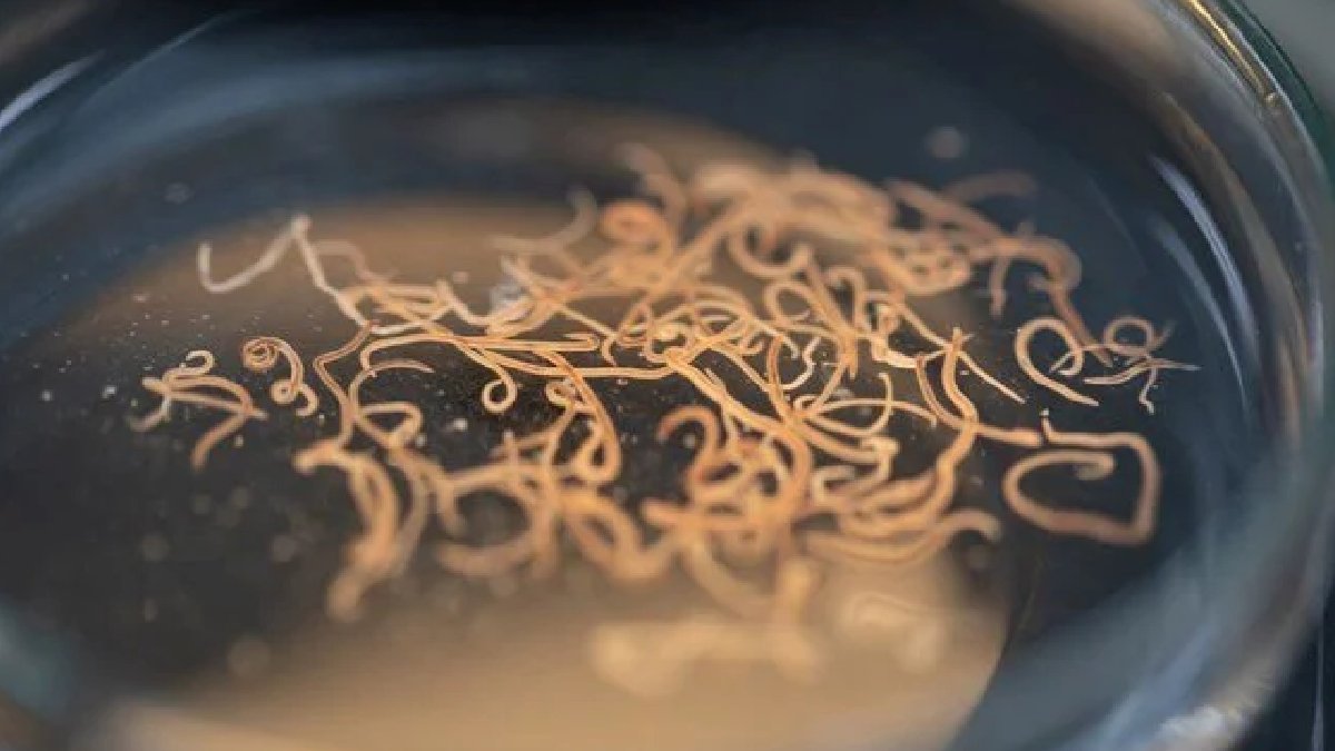 Ölümcül parazit alarmı: Vücutta yıllarca gizleniyor