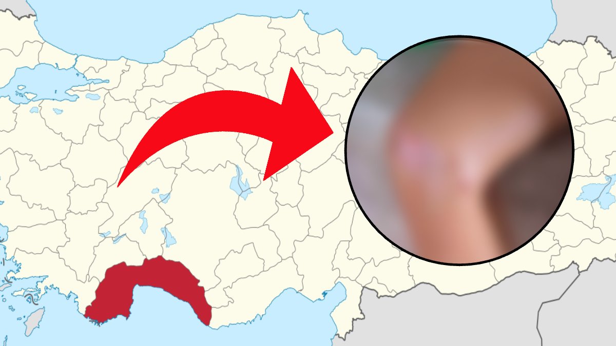 Antalya'nın o sahilinde denize girenlere kötü haber! Enfeksiyon şüphesi korkuttu: Denize giren çocuk hastanelik oldu