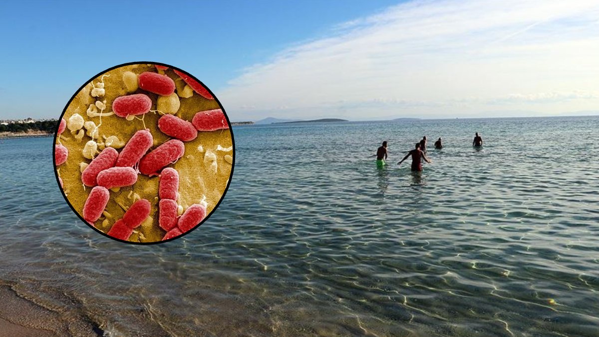 Ölüm saçan bakteri paniği! 4 kişinin ölümüne sebep oldu:"Et yiyen" mikropla ilgili kritik uyarı: Sakın o şekilde denize girmeyin