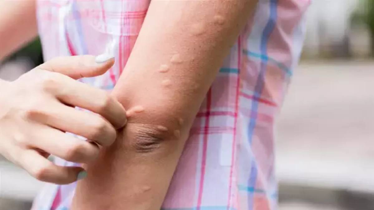 Ne kolonya ne kimyasal! Her evde olan bu mucize sineği kaçırıyor: Babaannelerin sandıkta kalan yöntemi