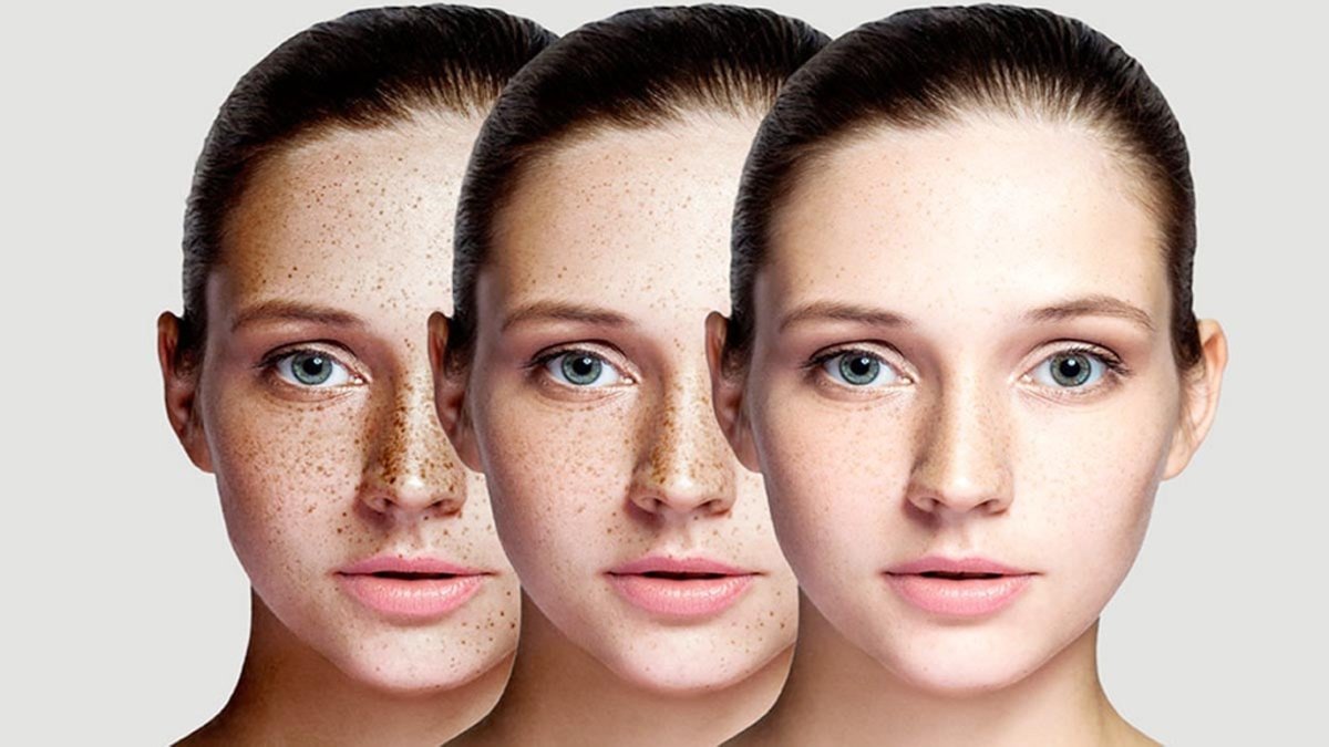 Evde doğal yöntemle ciltteki kararmalara ve yaşlılık lekelerine son! Haftada 2 kez uygula, farkı hemen gör!