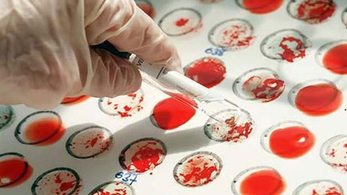 Uzmanlardan uyarı: Hangi kan gruptakiler mide kanserine daha yatkın?