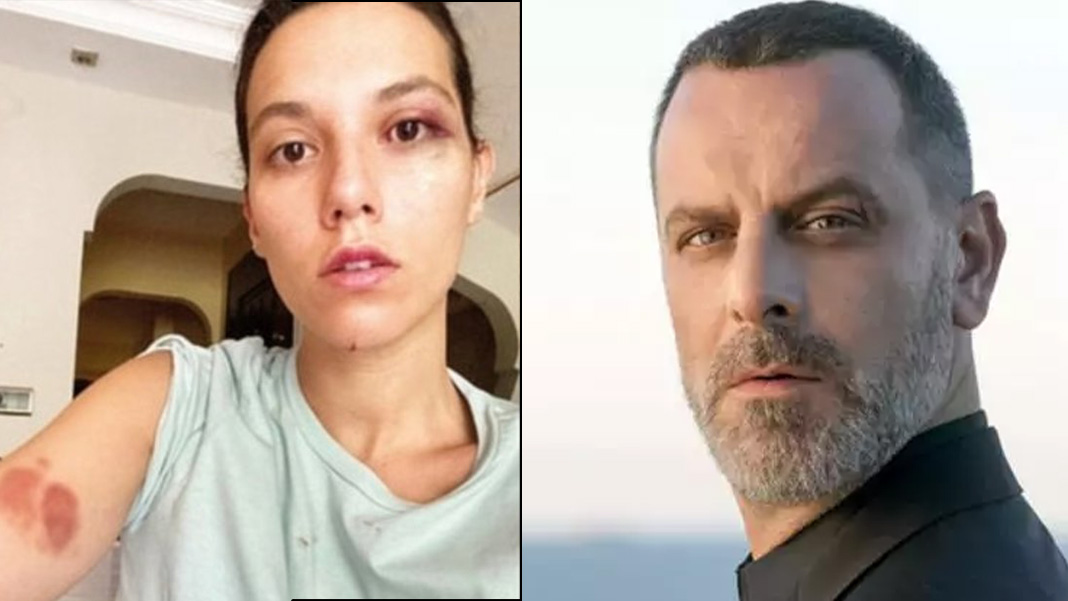 Ozan Güven’in eski sevgilisine darp davasında gerekçeli karar açıklandı