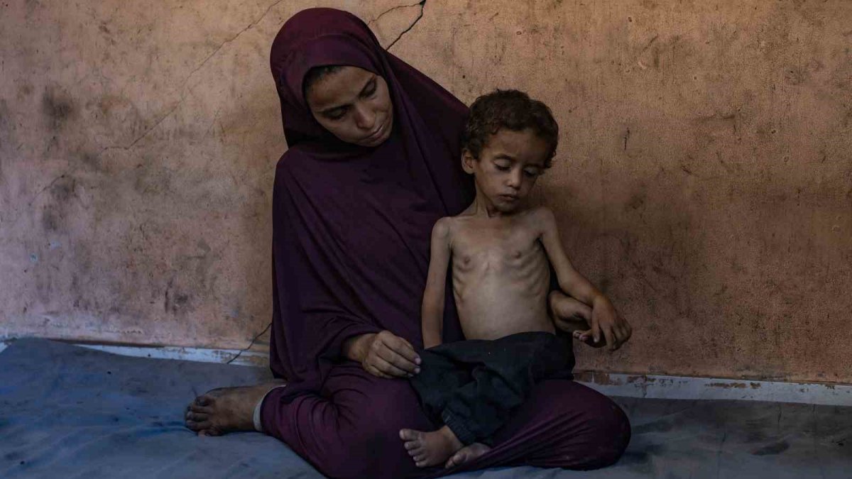 Gazze’de açlık nedeniyle can kaybı 113’e yükseldi