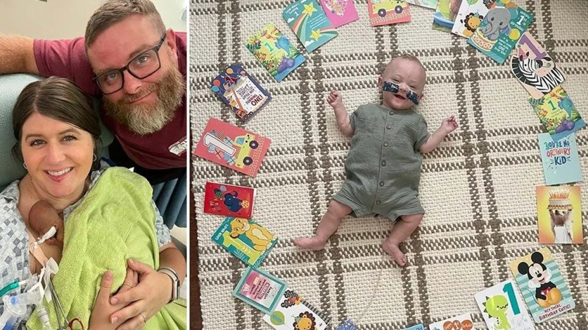 Dünyanın en prematüre bebeği 280 gram doğdu