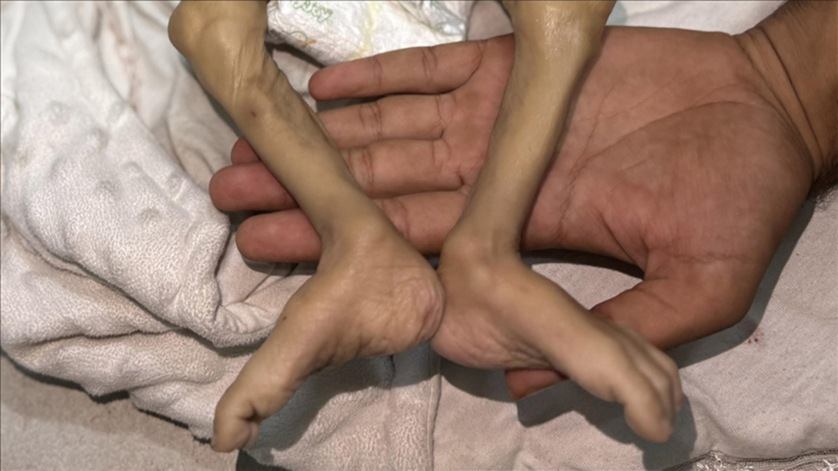 Gazze'de son 24 saatte 1'i çocuk 14 kişi açlıktan öldü