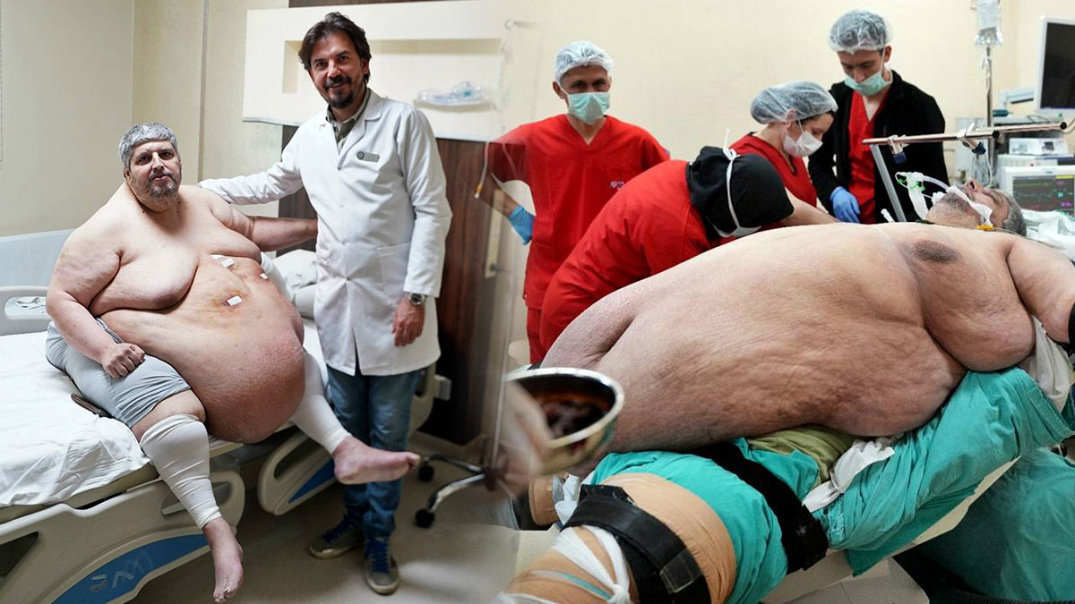 310 kiloluk adam artık yürümenin keyfini çıkarıyor! 49 yaşında hayata yeniden başladı