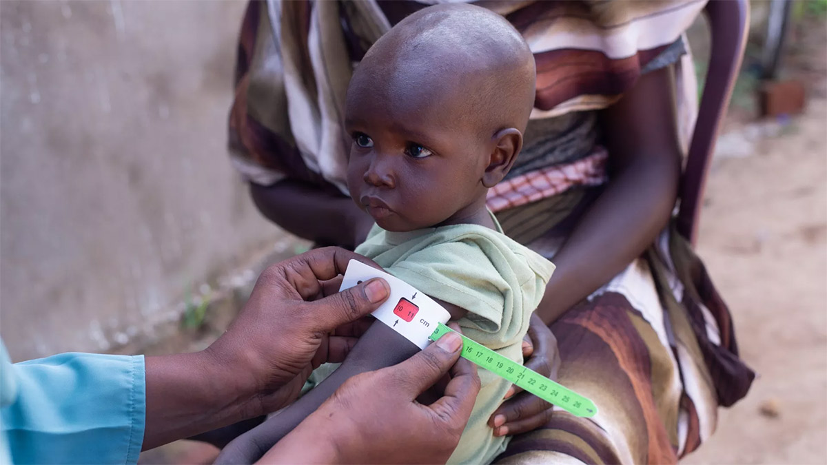 Darfur’un en büyük kampında 1700 çocuk aç