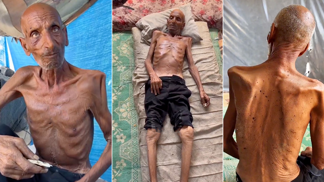Gazze'de Açlık: 75 Yaşındaki Salim Asfur 40 kiloya düştü