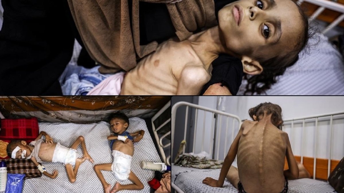 Gazzeli doktor, İsrail ablukası altında açlıkla boğuşan insanları anlattı: Kitaplarda okuduğumuz şeylere burada şahit oluyoruz