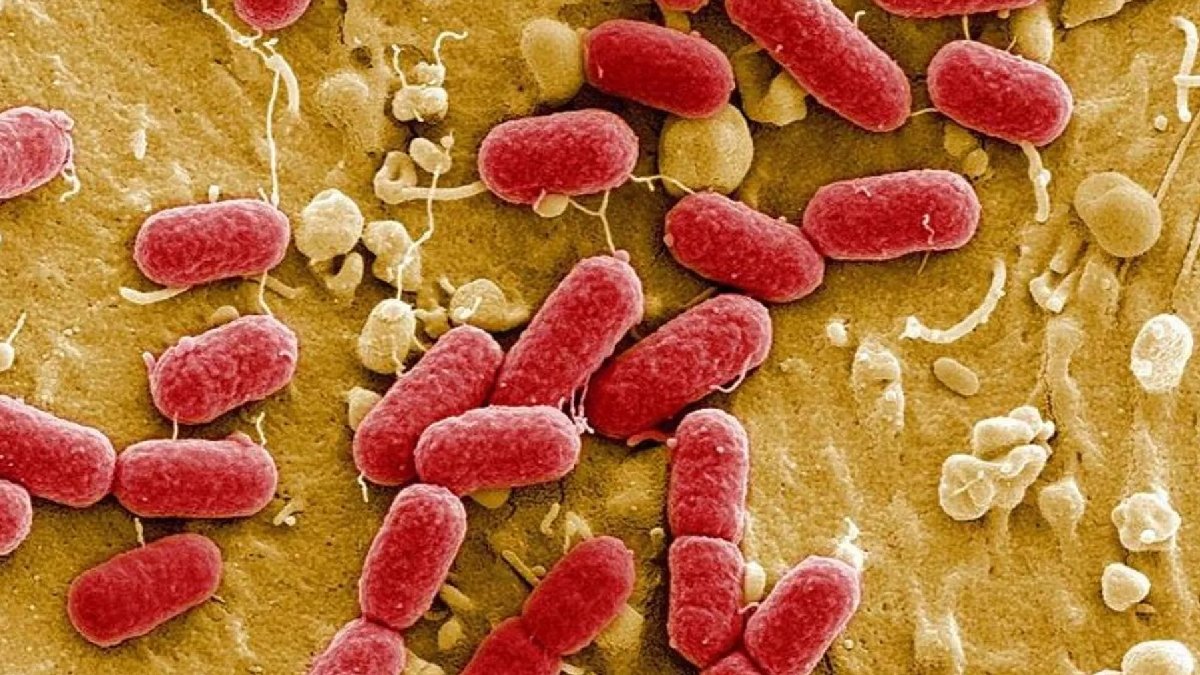 "Et yiyen bakteri" iddialarına cevap: Türkiye’de vaka yok