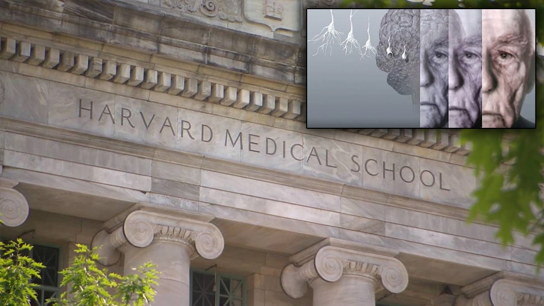 Bilim dünyasında deprem etkisi yaratan keşif: Alzheimer'ın nedeni bulundu