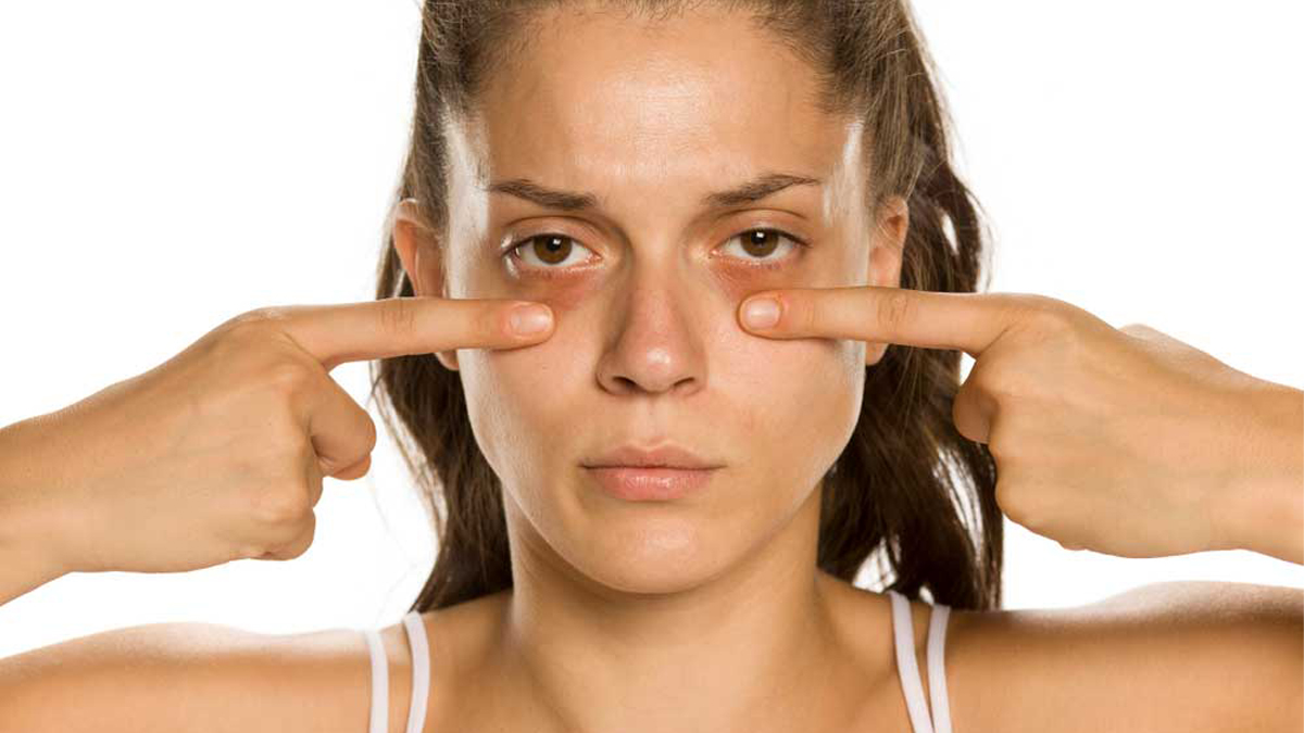 Göz altı morlukları artık tarih oluyor: Tek bir malzemeyle mucize yaratın