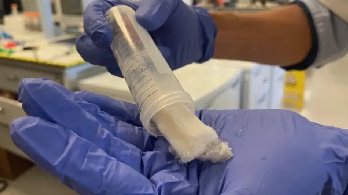 Saçtan üretilen diş macunu çürümeyi durdurabilir