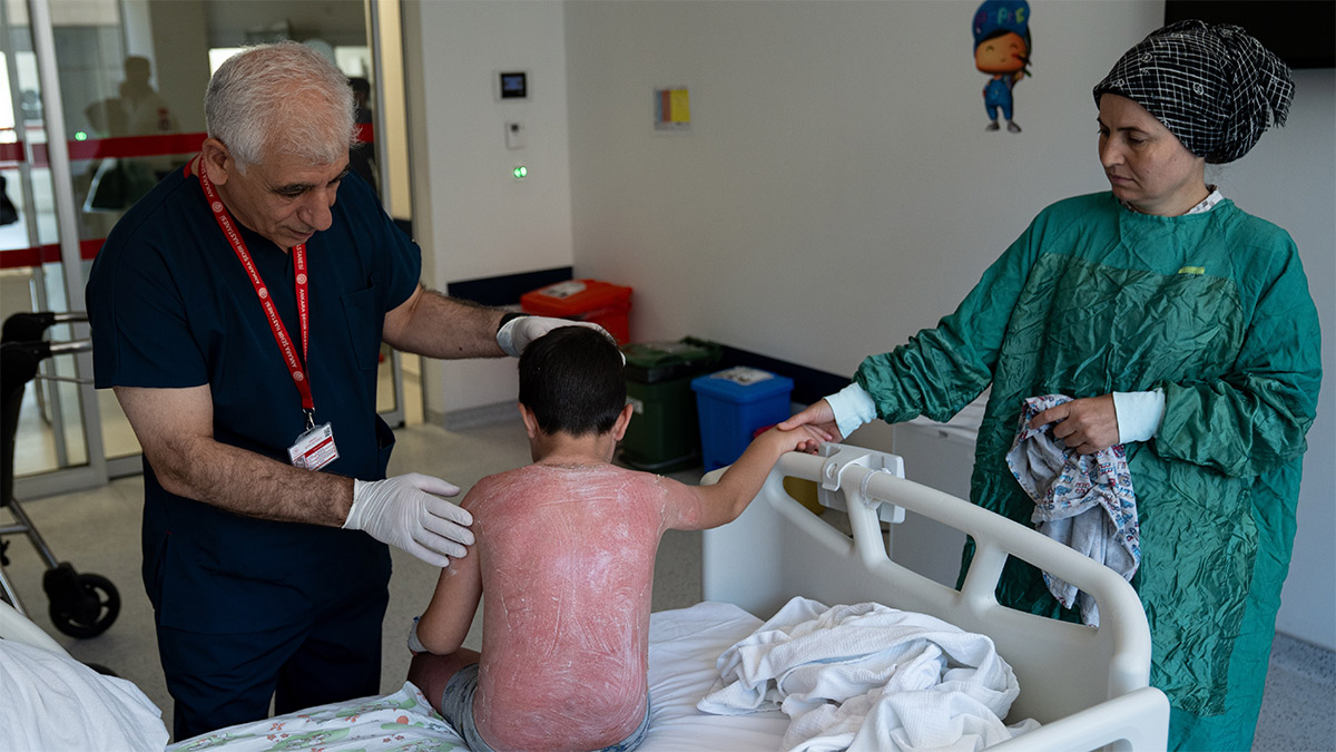 Güneşte saatlerce kalan küçük çocuk hastanelik oldu: 'Krem sürmeyi unuttuk'