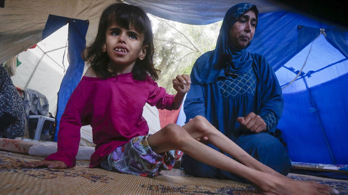 Açlık insan vücudunu nasıl etkiler? BM'den Gazze için açlık uyarısı